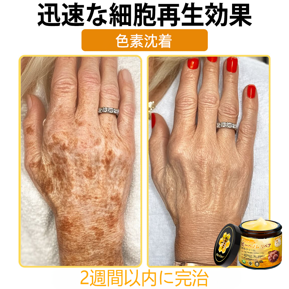 🧑‍⚕️PuraCure® ビーベノム リペア再生クリーム🔥天然由来のエイジングケアで肌を引き締め、ハリを与え、乾燥による小ジワを目立たなくします – 50mL