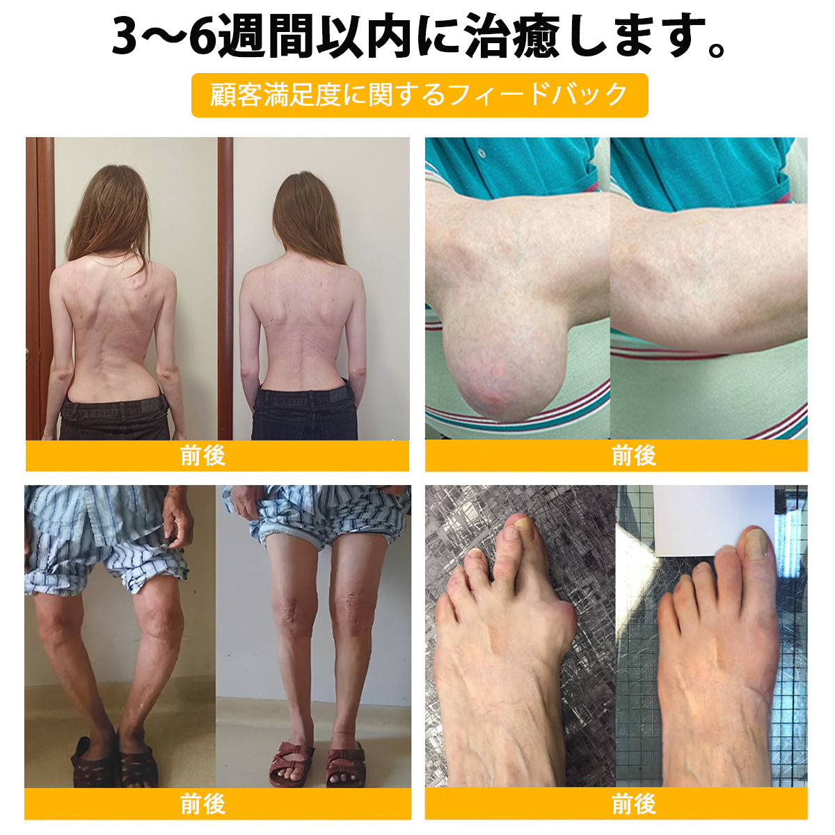 ⚡BSWELL® ハチ毒エキス配合 関節ケアクリーム｜関節サポート・膝・腰・肩の違和感ケア｜ニュージーランド産原料使用 高機能リペアクリーム