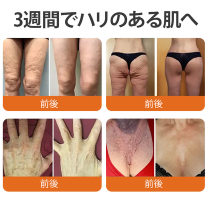 🧑‍⚕️PuraCure® ビーベノム リペア再生クリーム🔥天然由来のエイジングケアで肌を引き締め、ハリを与え、乾燥による小ジワを目立たなくします – 50mL