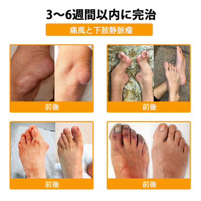 ⚡BSWELL® ハチ毒エキス配合 関節ケアクリーム｜関節サポート・膝・腰・肩の違和感ケア｜ニュージーランド産原料使用 高機能リペアクリーム