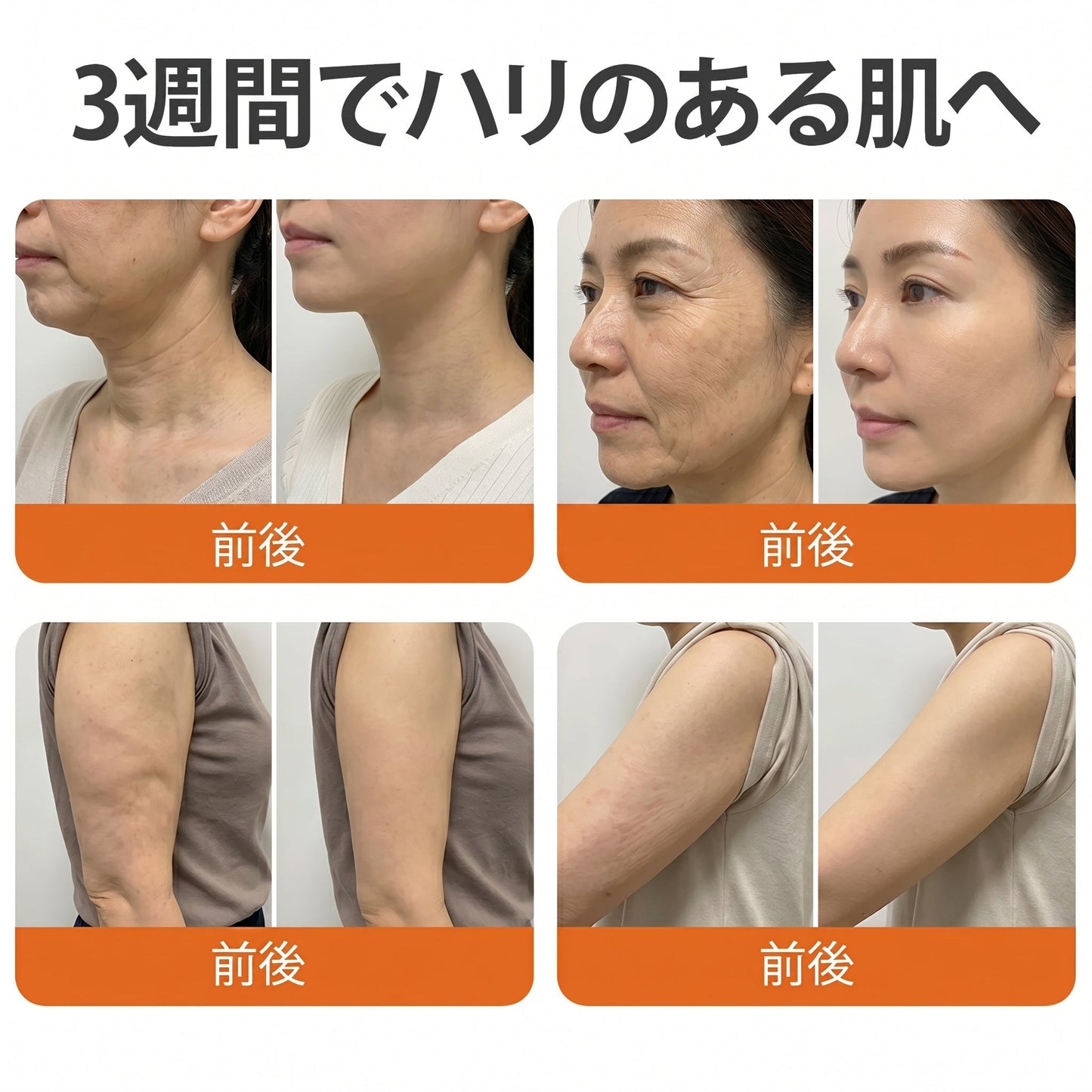 🧑‍⚕️PuraCure® ビーベノム リペア再生クリーム🔥天然由来のエイジングケアで肌を引き締め、ハリを与え、乾燥による小ジワを目立たなくします – 50mL
